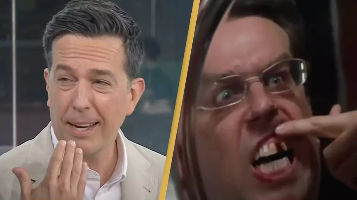 Hangover star Ed Helms reveals missing tooth is actually real