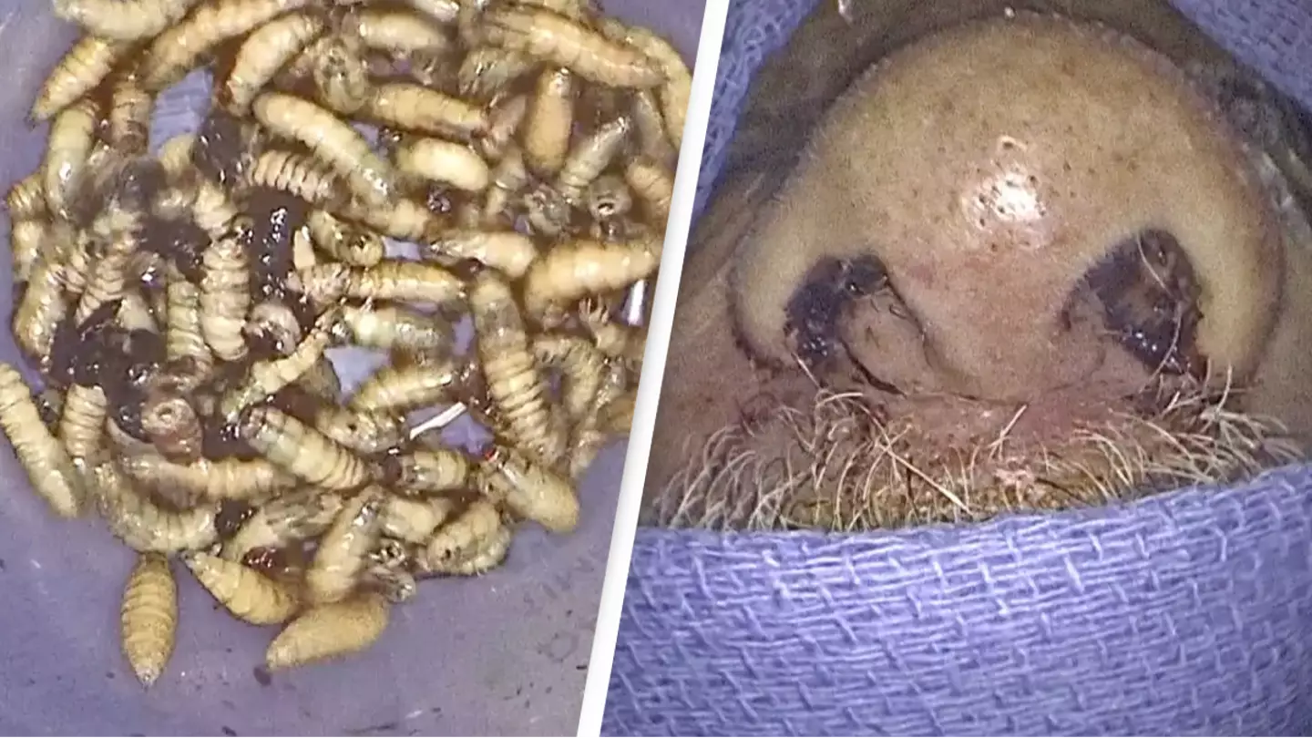 Man has 150 live bugs removed from his nose after feeling ‘off’ for months