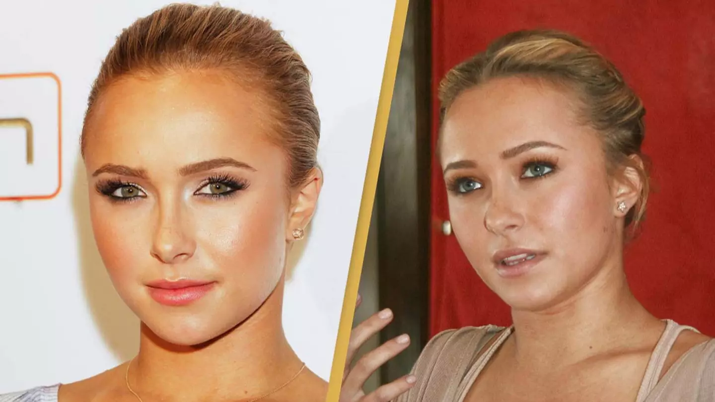 Hayden Panettiere opens up on why she relapsed after drug addiction left her jaundiced