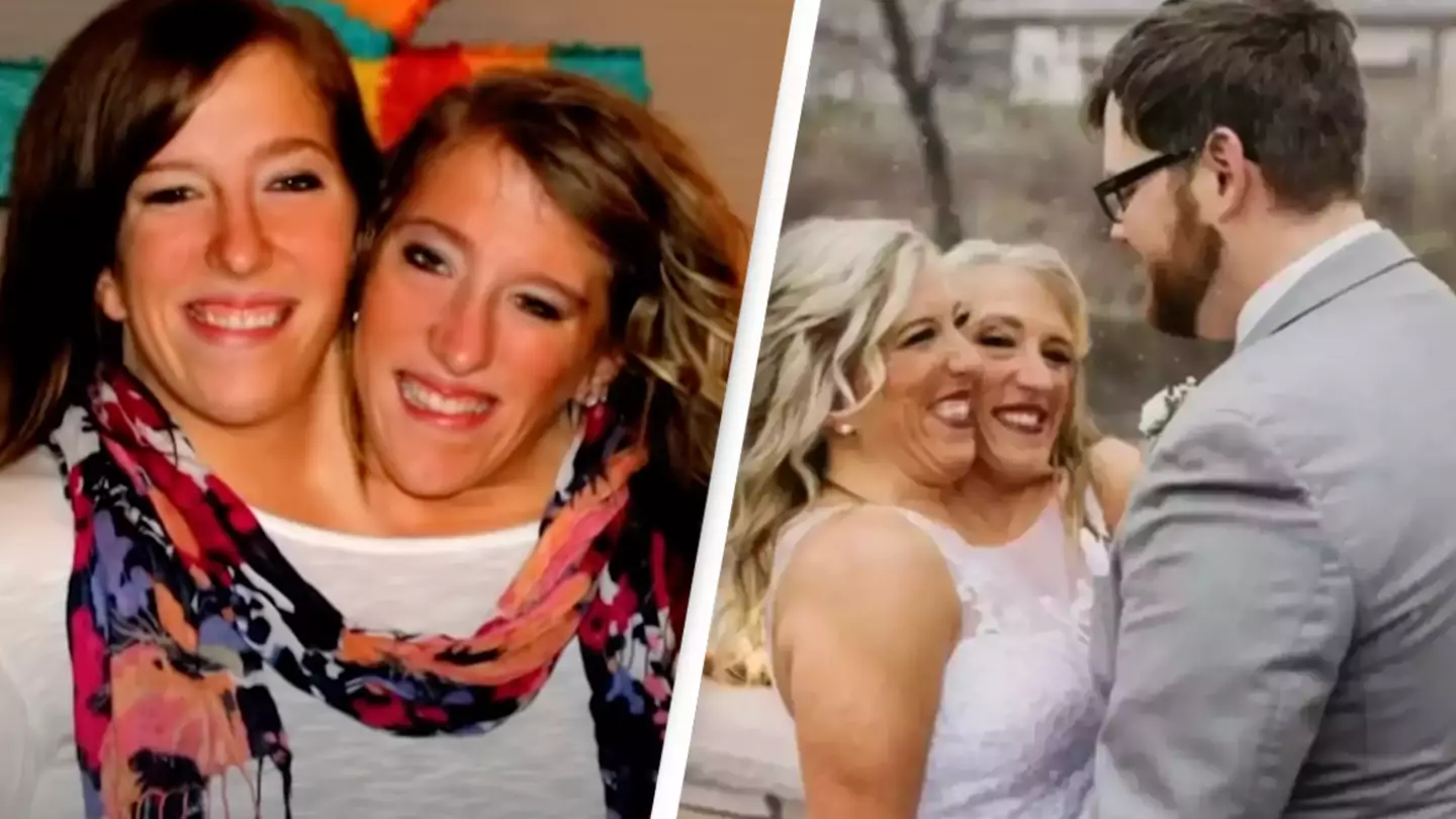 Conjoined twins hit out at the 'haters' in new post after revealing Abby Hensel got married
