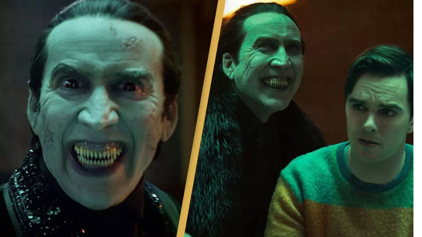 Nicolas Cage shaved his teeth down to transform into Dracula