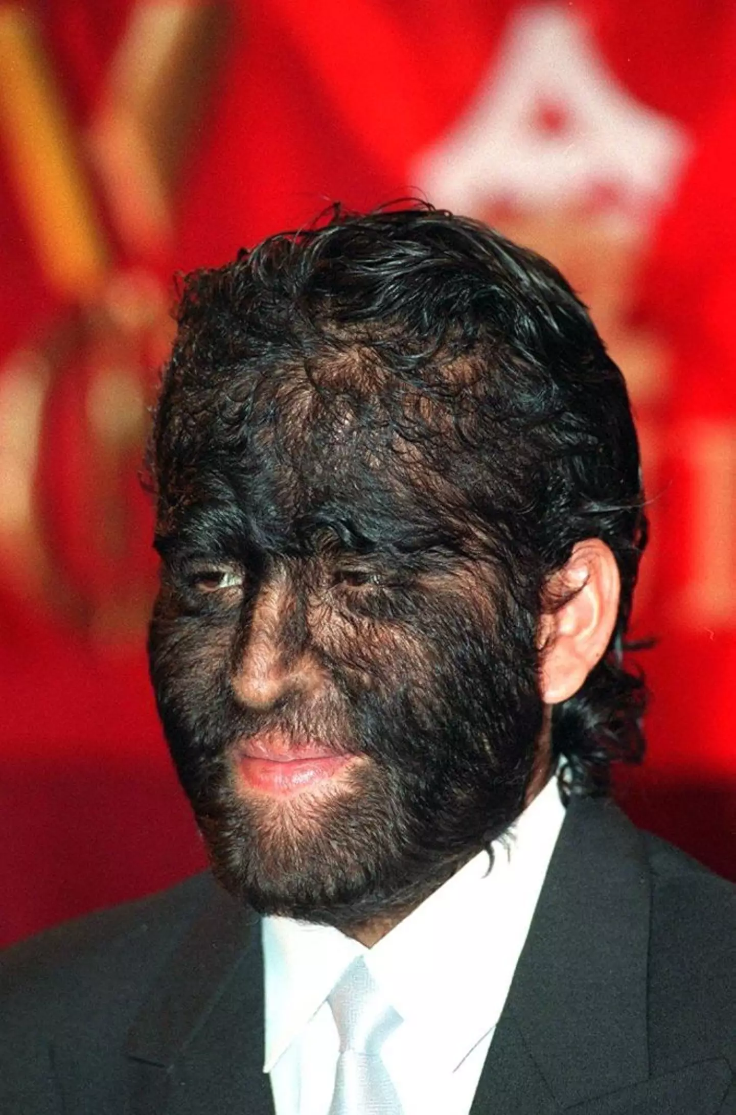Jesus Manuel Fajardo Aceves is a member of the world's hairiest family. (TAO-CHUAN YEH/AFP via Getty Images)