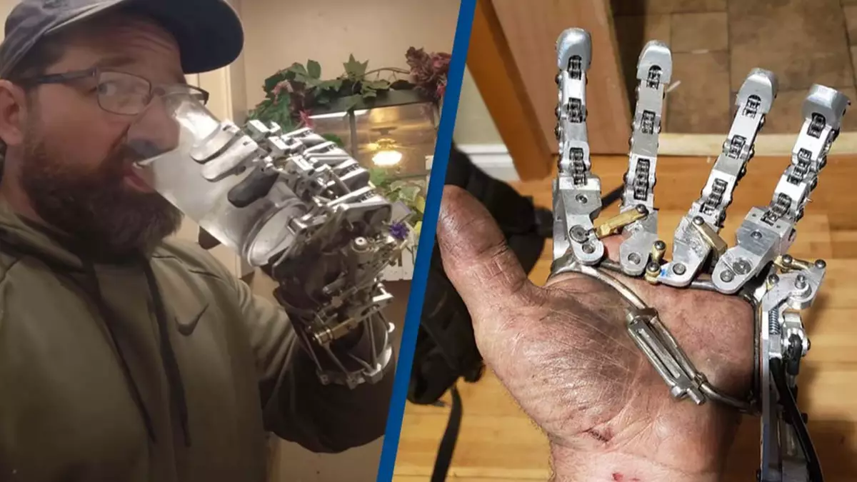 Man creates his own working bionic hand after medical insurance company refused to pay for one