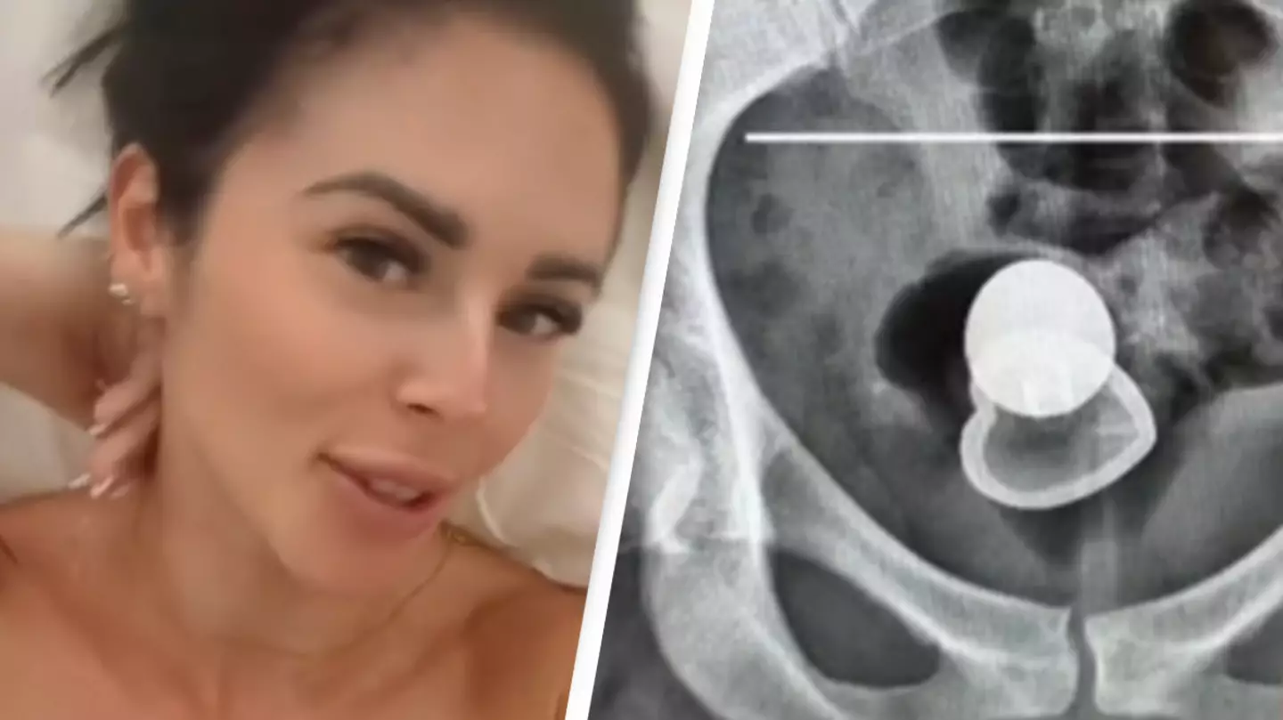 Woman hospitalized after first date ends with NSFW accident in the bedroom