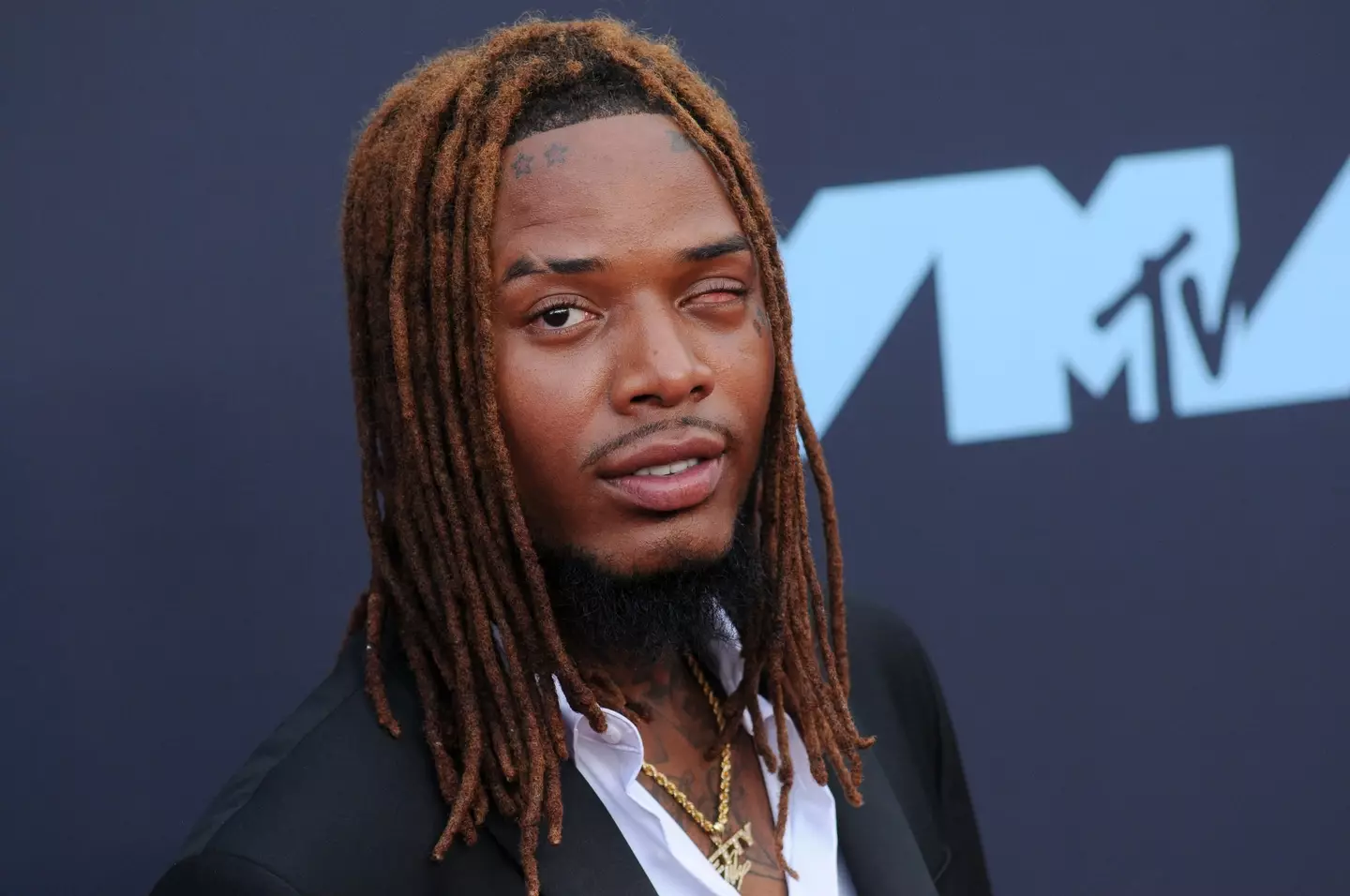 Fetty Wap shot to stardom in 2015 after the release of his debut album.