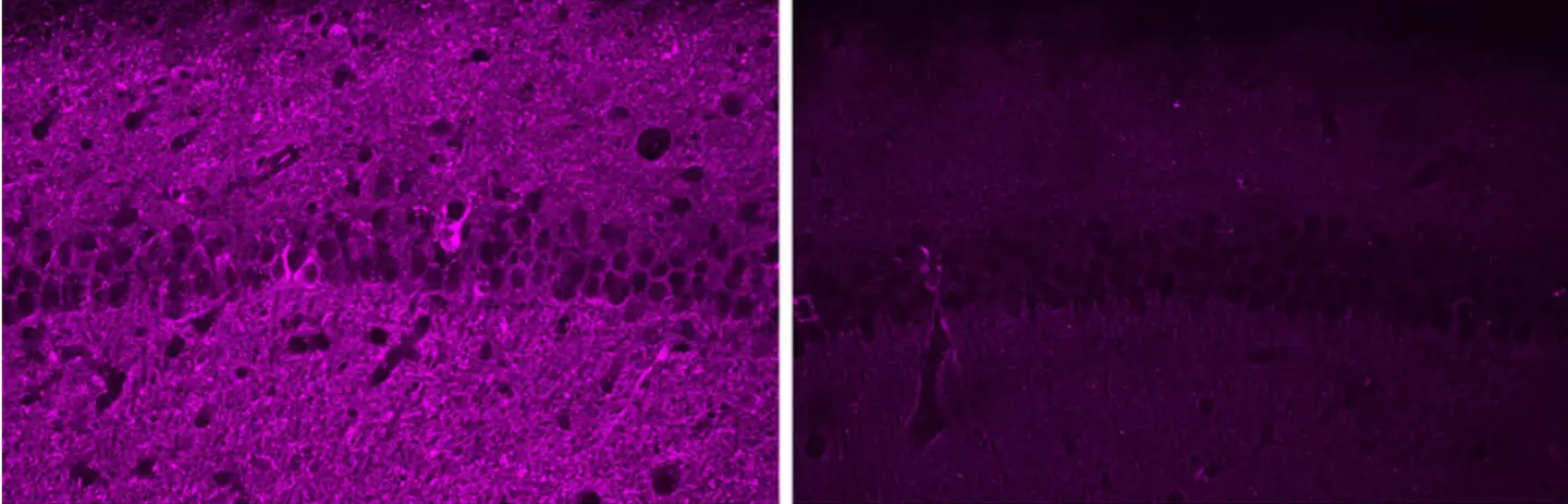 The left picture shows the prevalence of Tau proteins in the neurons from mice with a scrambled version of the peptide. The right picture shows mice with the new peptide.