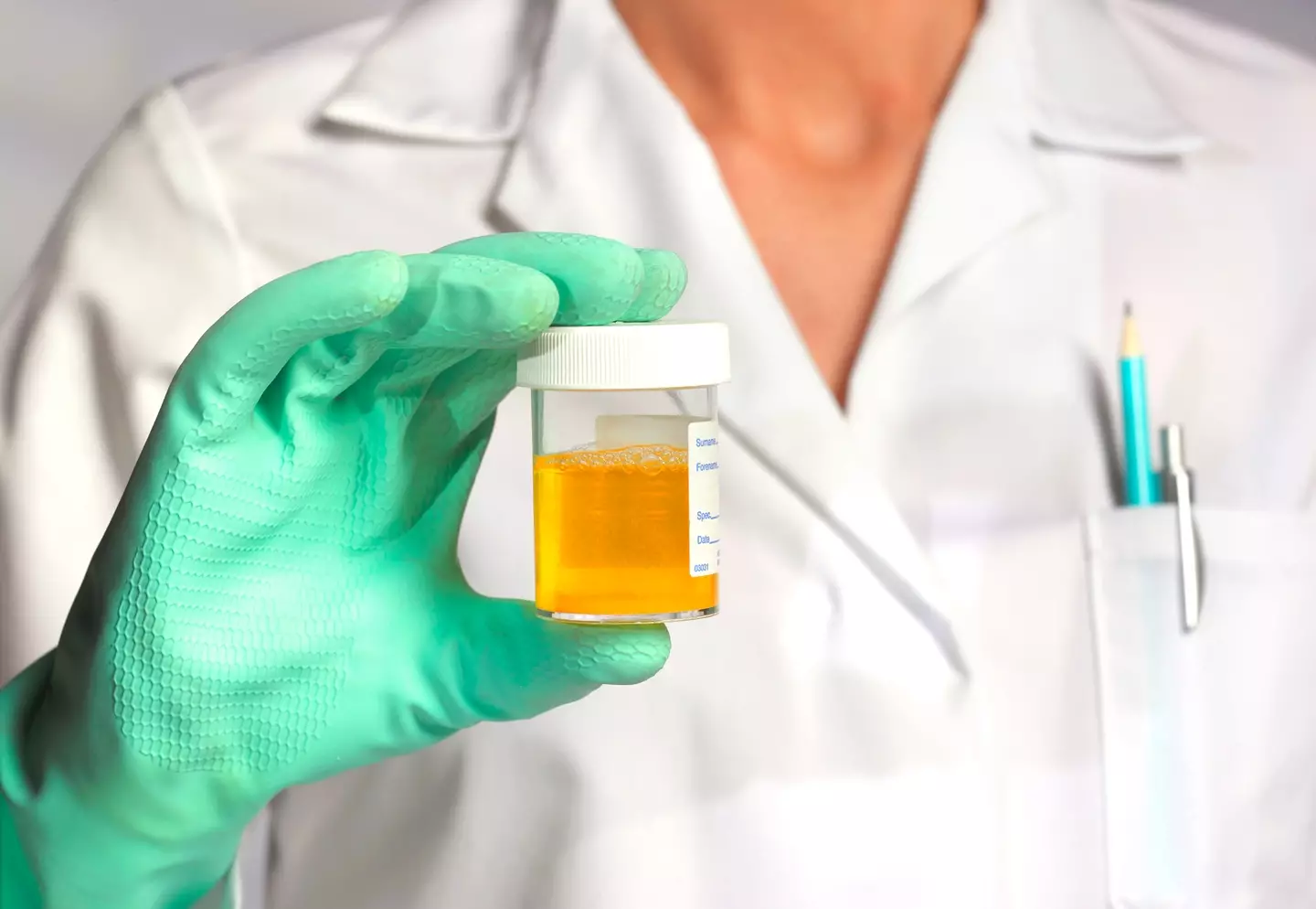 Why urine is yellow became a 150-year mystery.