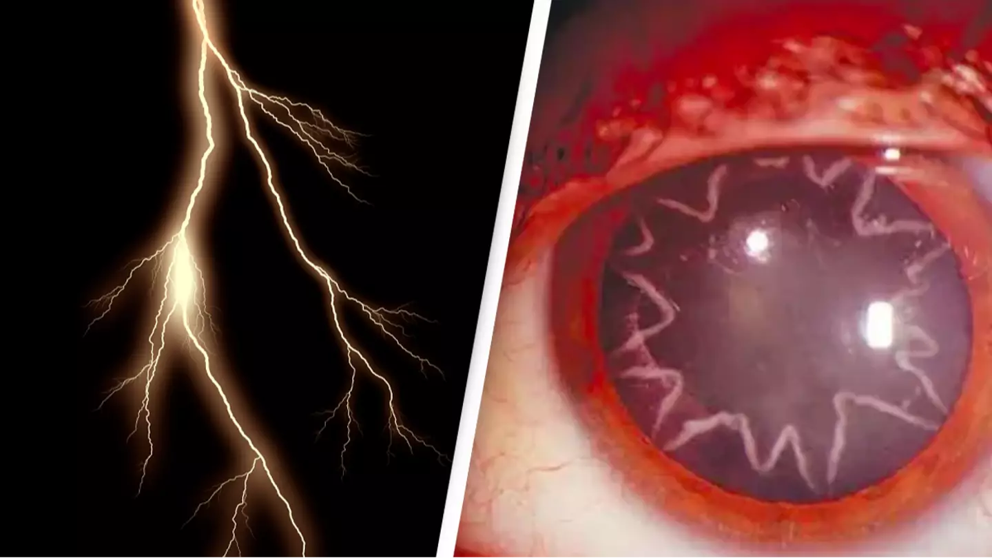 Electrician left with bizarre burns in his eyes after being zapped by 14,000 volts of electricity