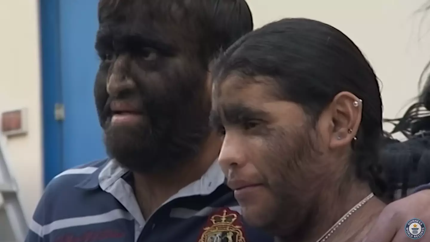 The family have a condition called congenital generalised hypertrichosis. (Guinness World Records/YouTube)