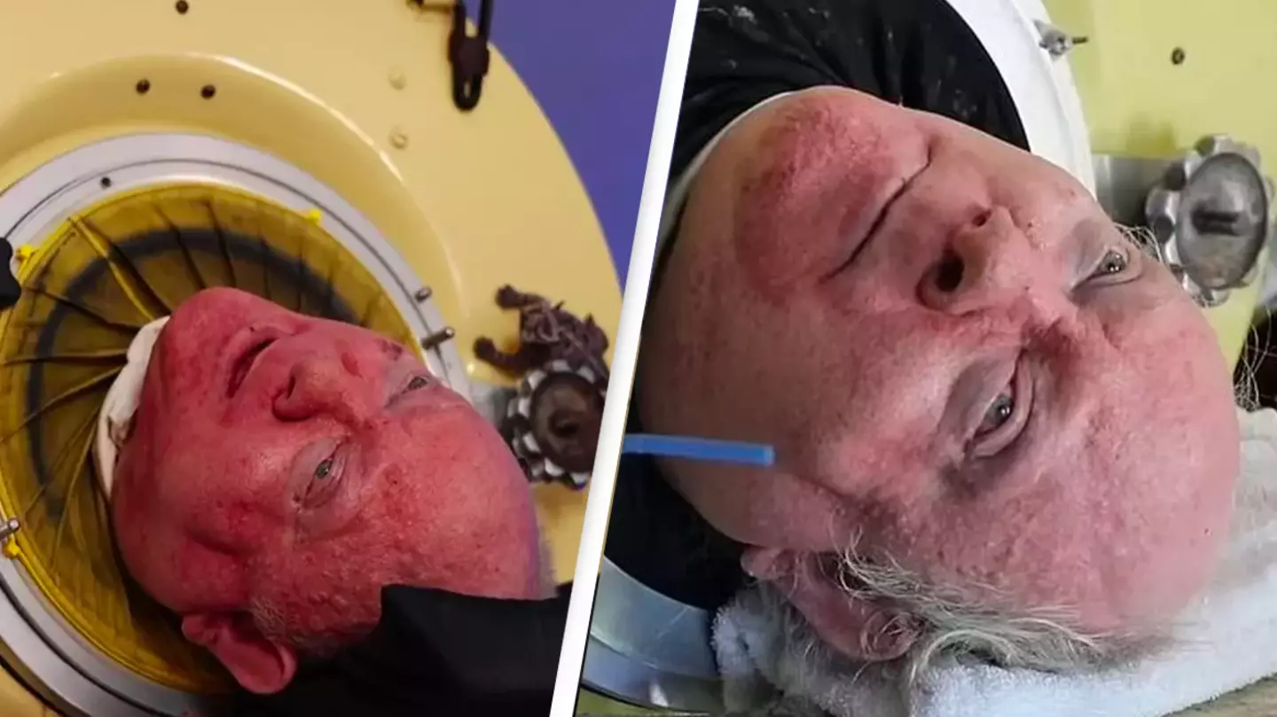 Man who lived inside seven foot iron lung for over 70 years has died aged 78