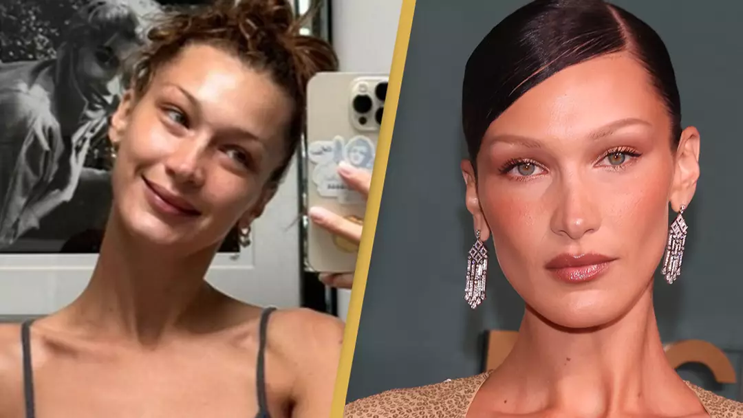 Fans Criticize Bella Hadid After She Shares Friend S Gofundme Page