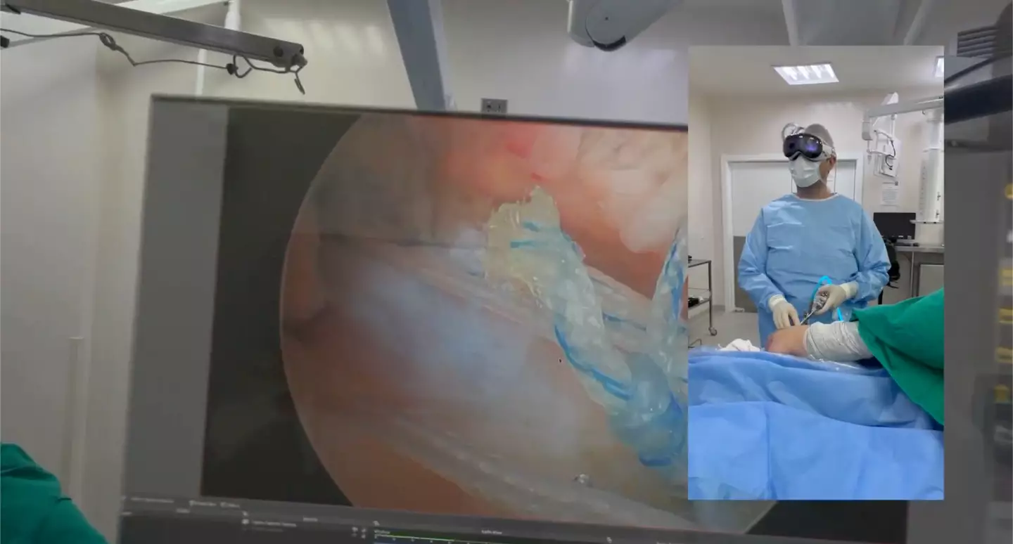 The device had the screens up in front of the surgeon. (YouTube / ombroecotovelo)
