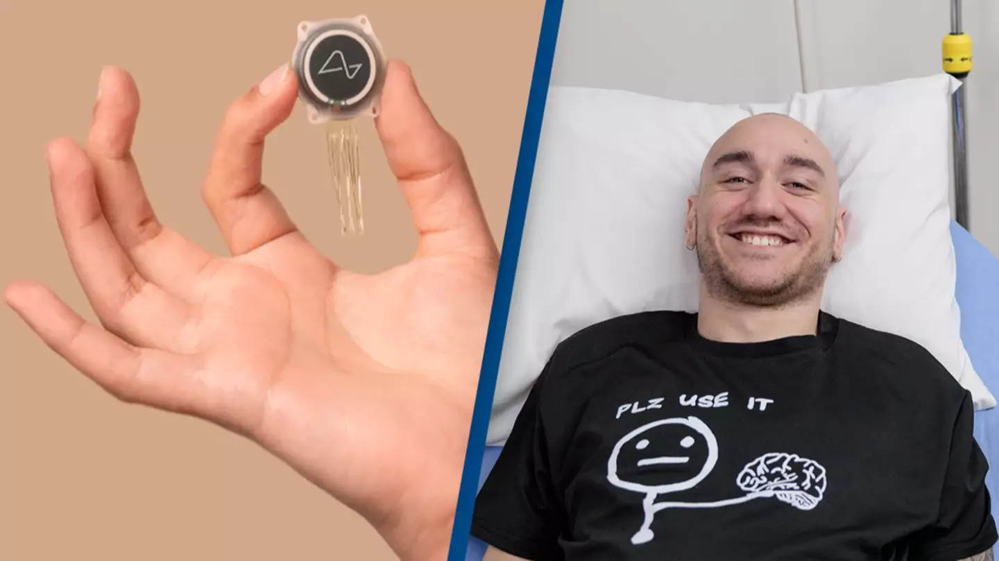 First ever Neuralink patient says approximately 85% of implant wires became detached in just weeks