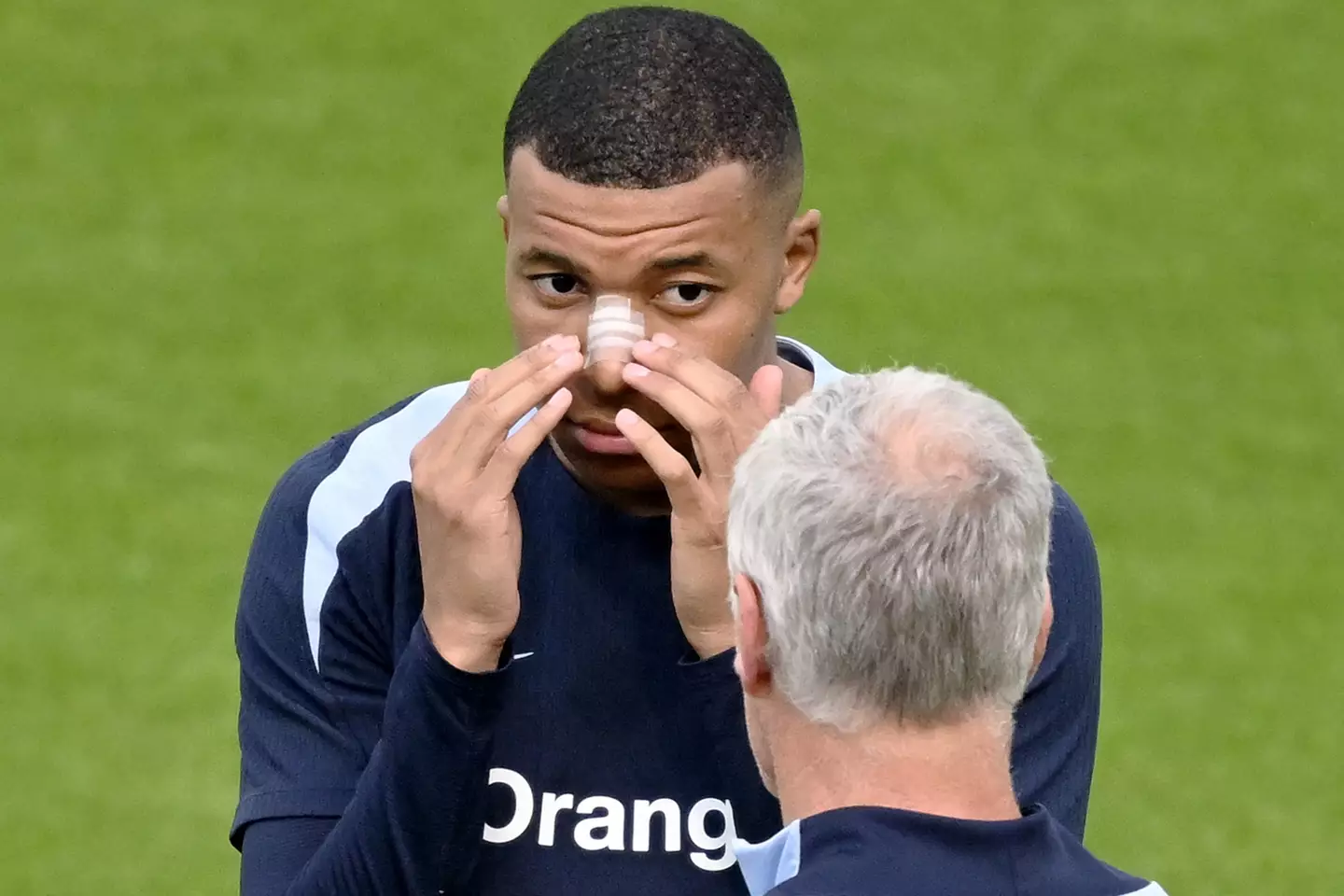 Kylian Mbappe sports a bandage on his broken nose. Image: Getty 