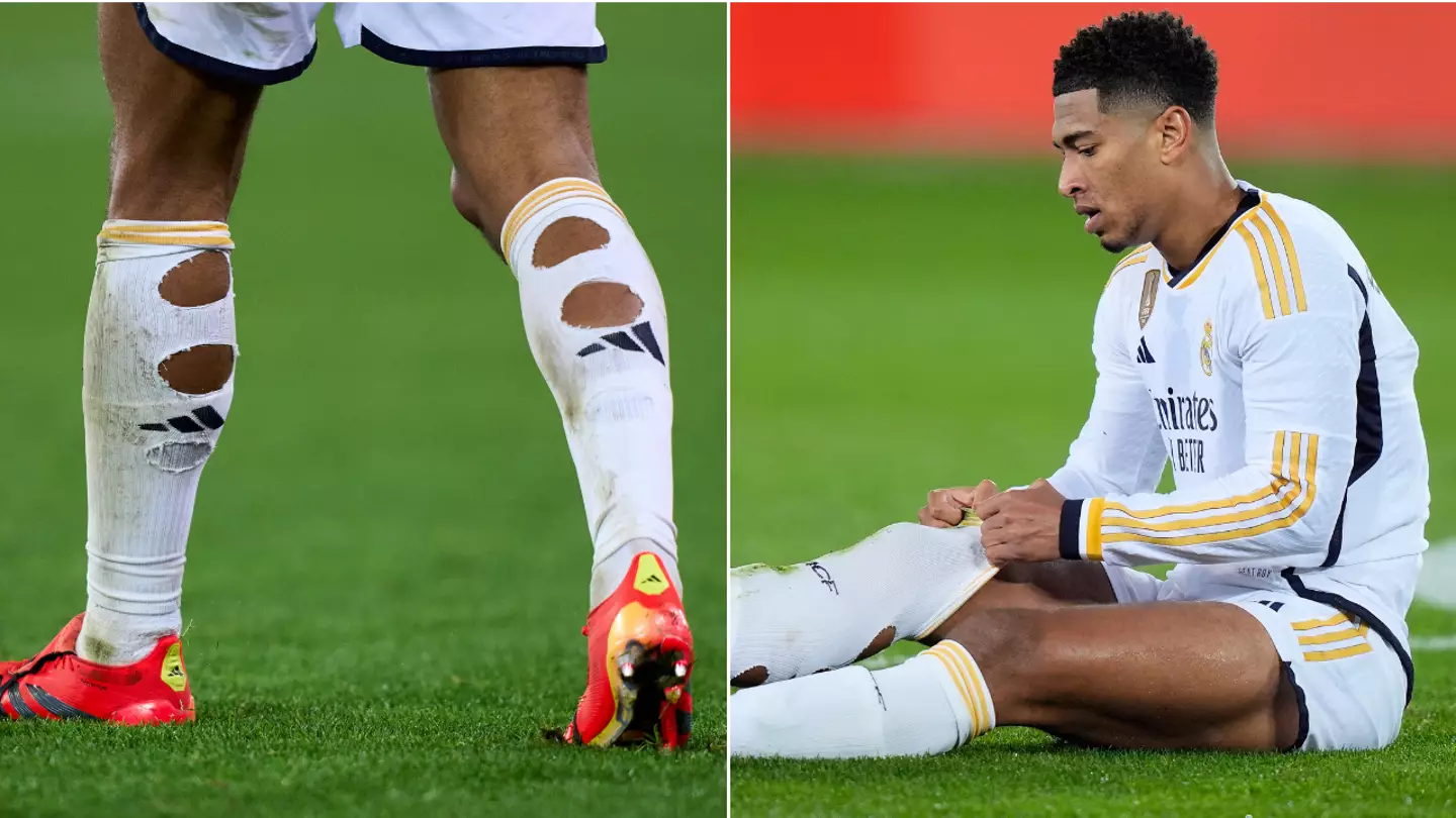 The reason footballers cut holes in their socks before matches