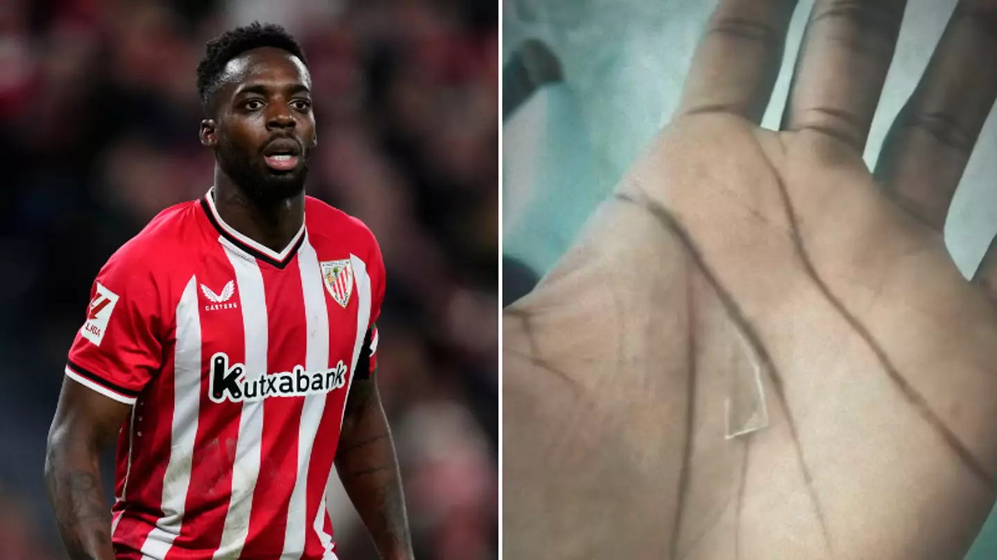 Athletic Bilbao forward Inaki Williams has somehow played the last two years with one of the most painful injuries you can think of