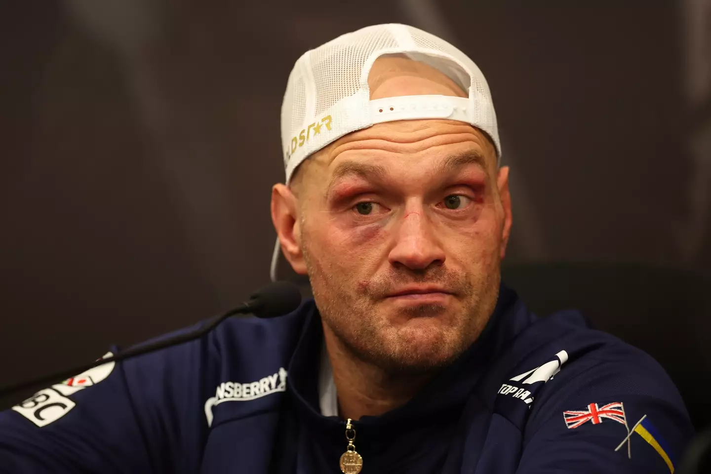 Tyson Fury after his first defeat. (