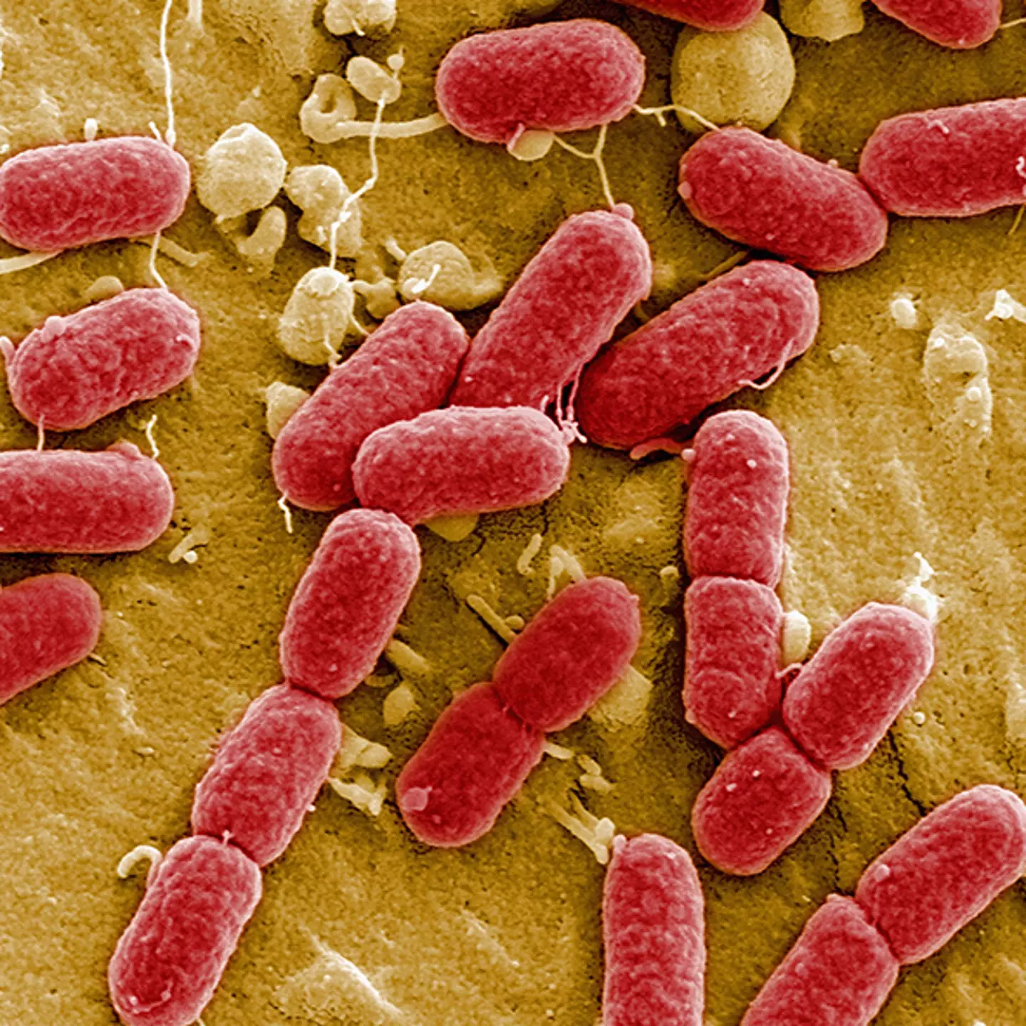 Scientists hail new antibiotic that can kill drug-resistant bacteria