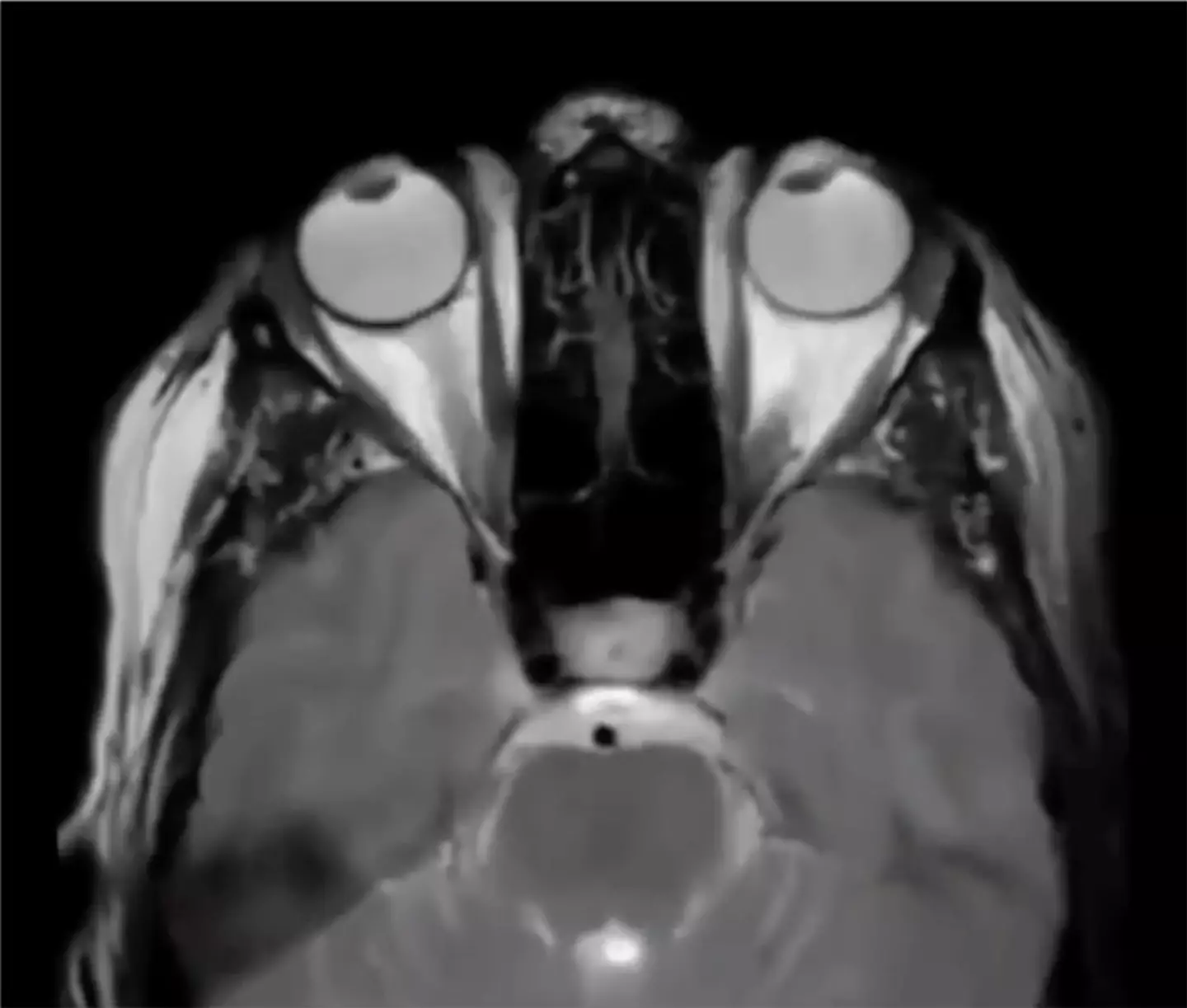 The video appears to show someone in REM sleep during an MRI scan (Reddit/@immatureboy7)