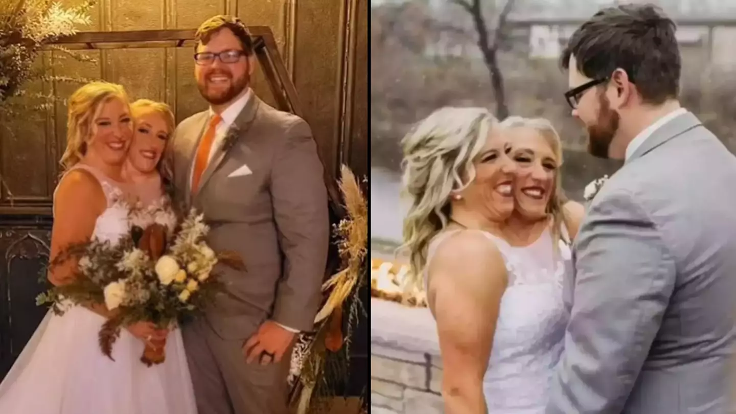 Conjoined twin Abby Hensel shares never-before-seen photos from wedding day and people have so many questions