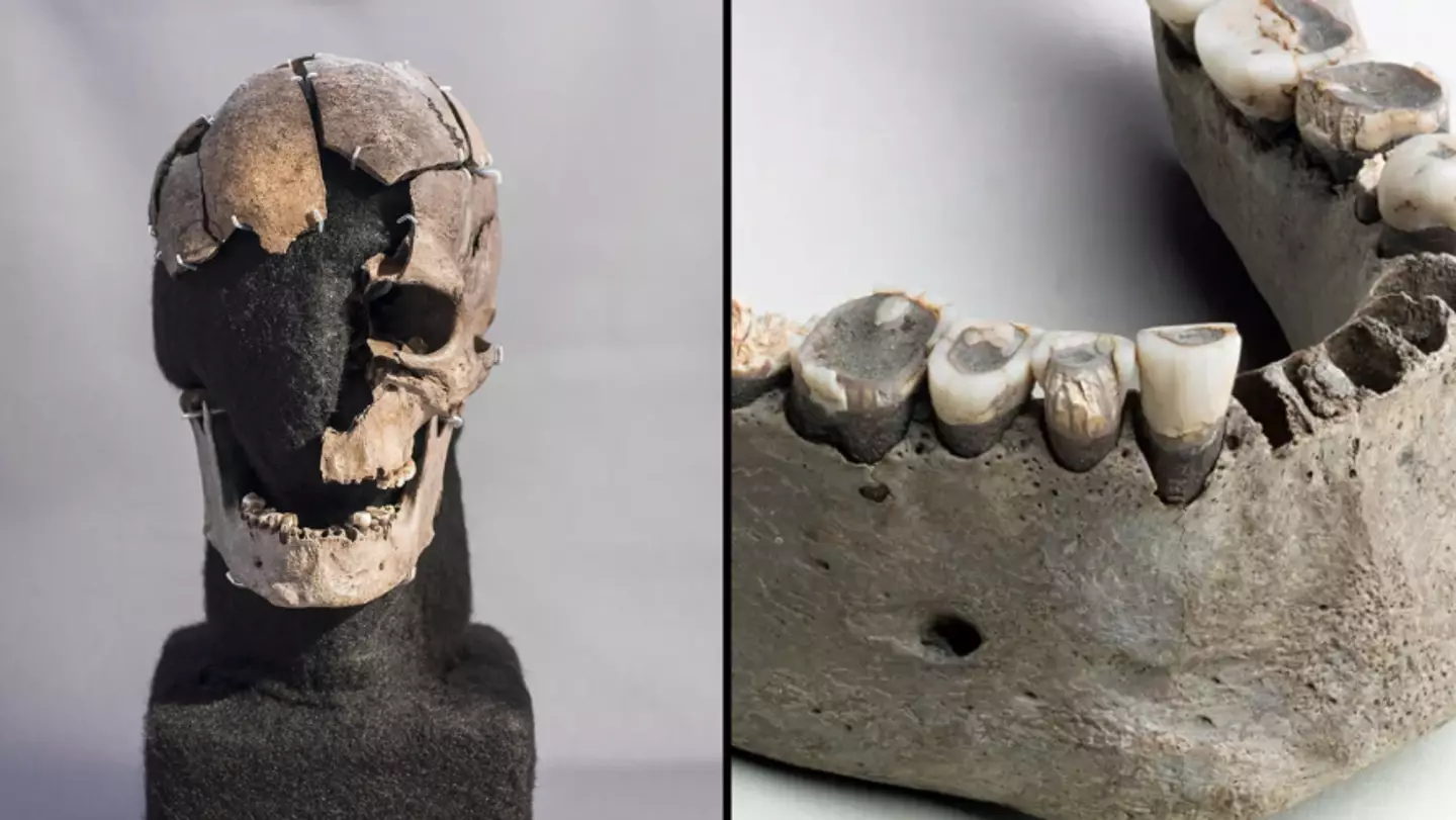 Ancient man so well preserved that scientists think they know what he ate before violent death