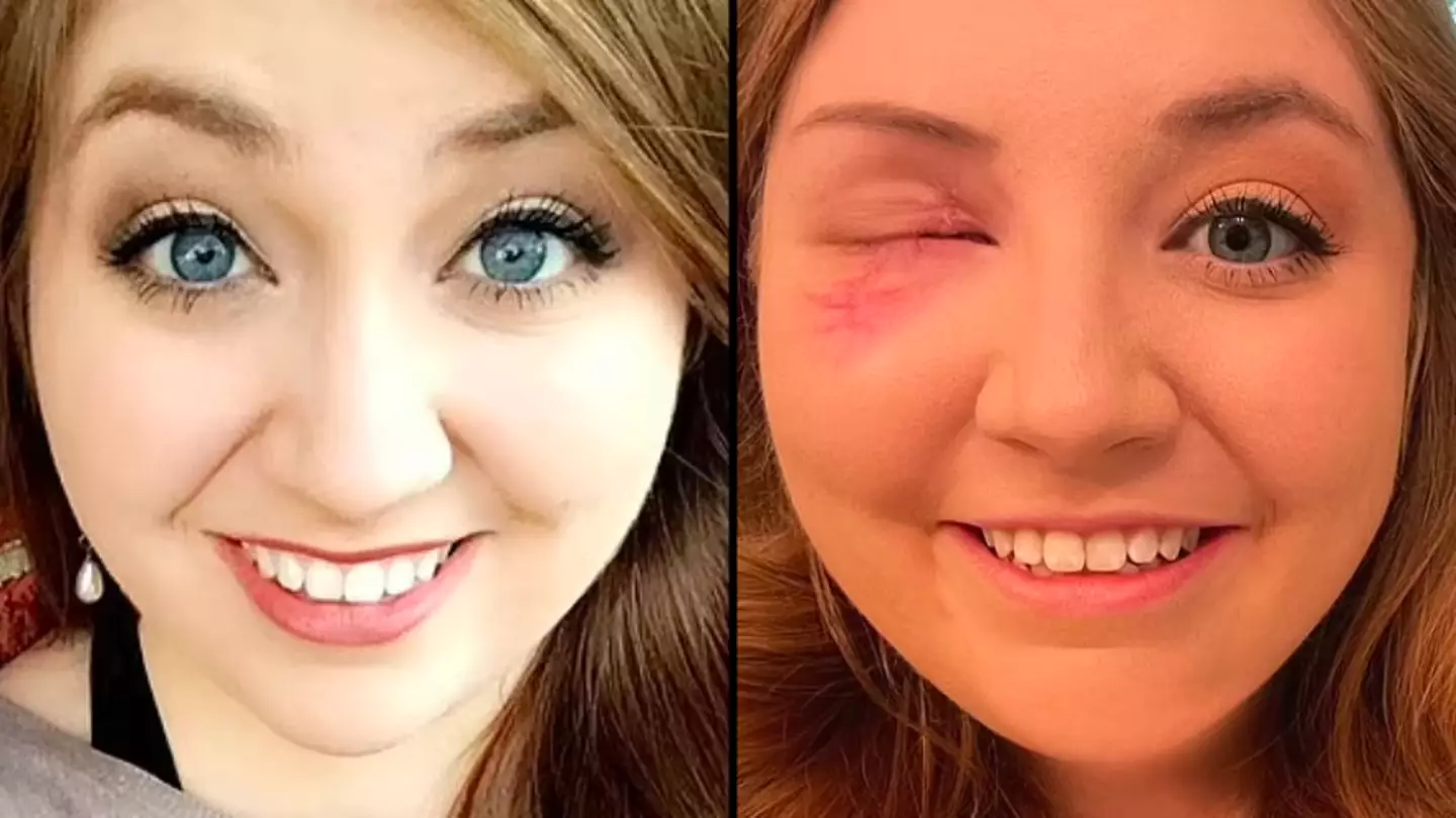 Woman issues warning after unexpectedly losing her eye in minor car crash