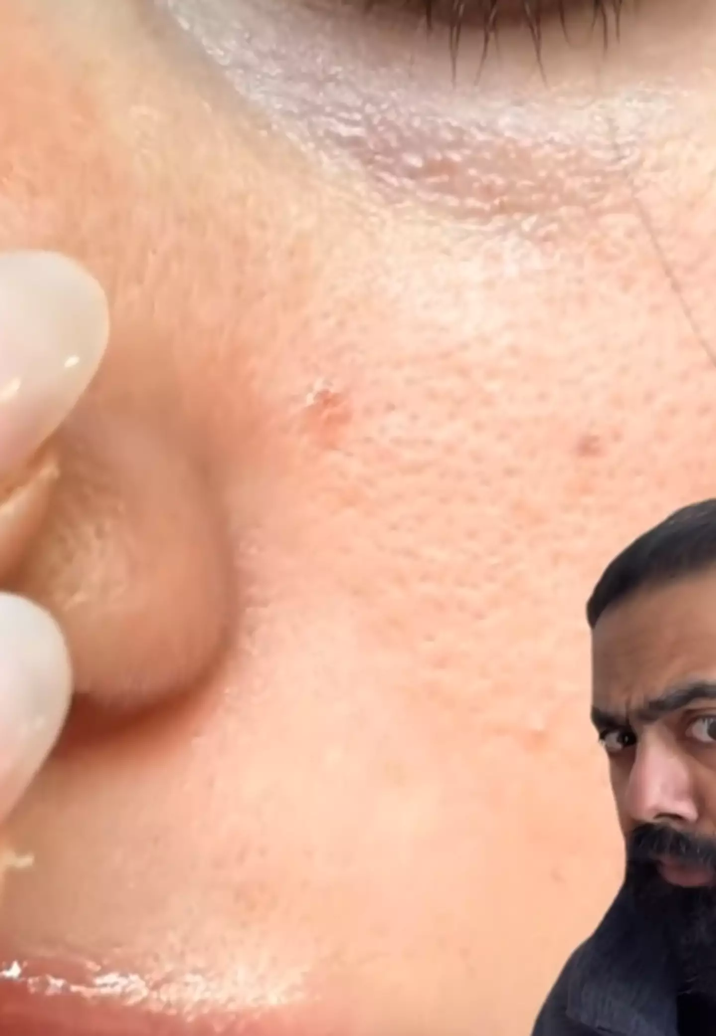 Dr Karan Rajan explained what skin cancer could look like. Instagram/ @drkaranrajan
