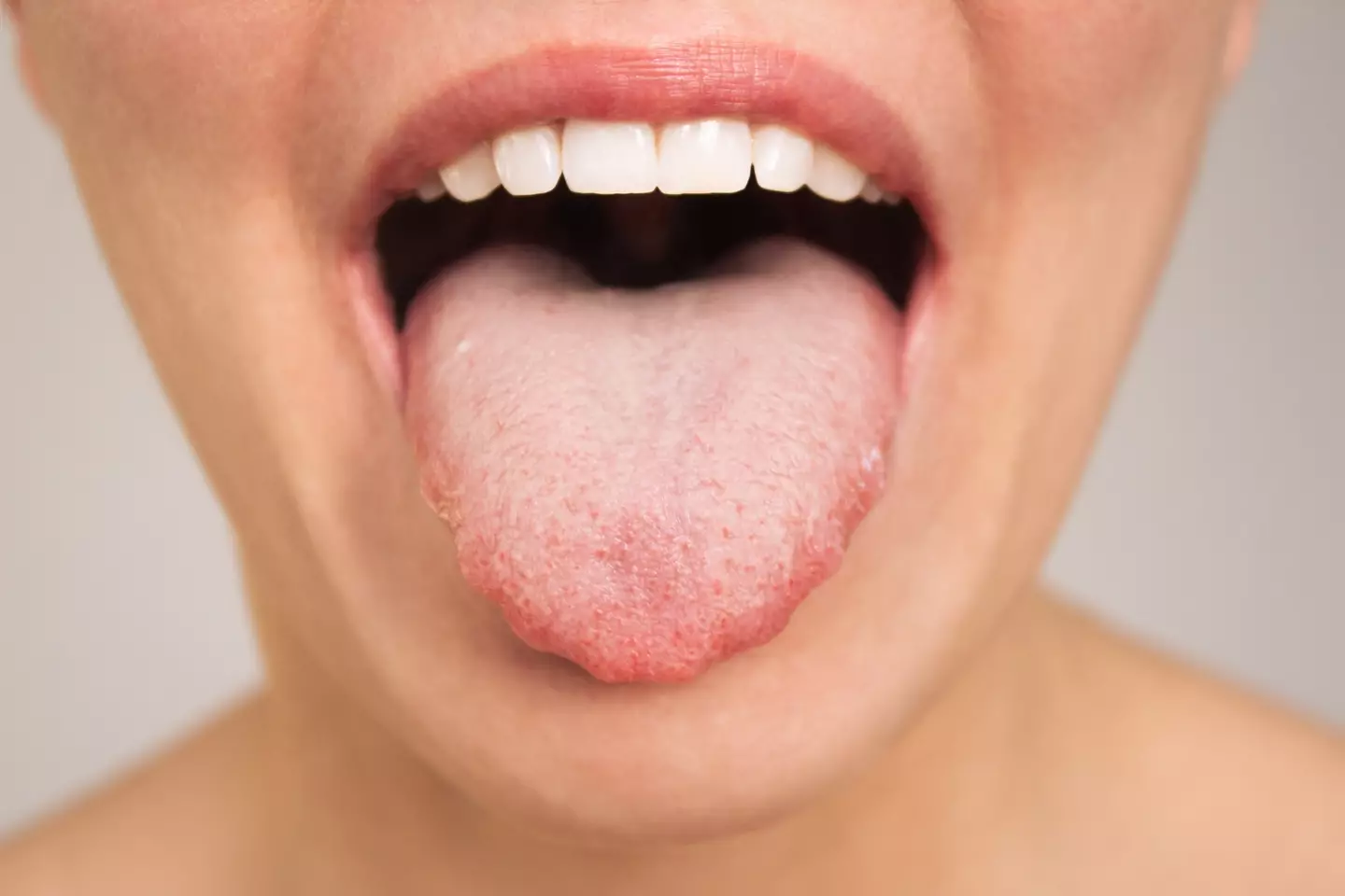 Look out for cracks in your tongue with a 'thick yellow coating'. (Getty Stock Image)