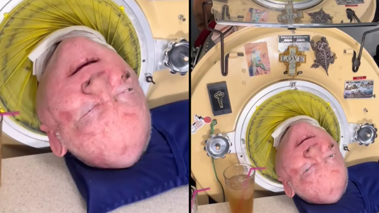 Man who's lived inside iron lung machine for more than 70 years still has to pay to stay alive