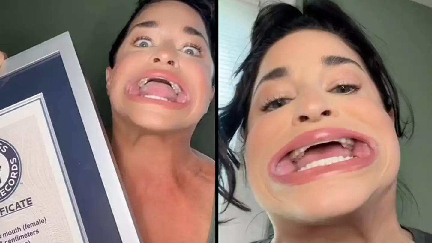 Woman who holds Guinness World Record for largest mouth gape has now broken a second one