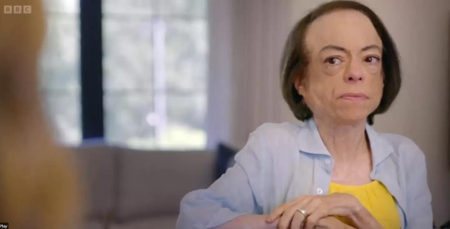 Liz Carr's documentary looks at assisted dying (BBC)