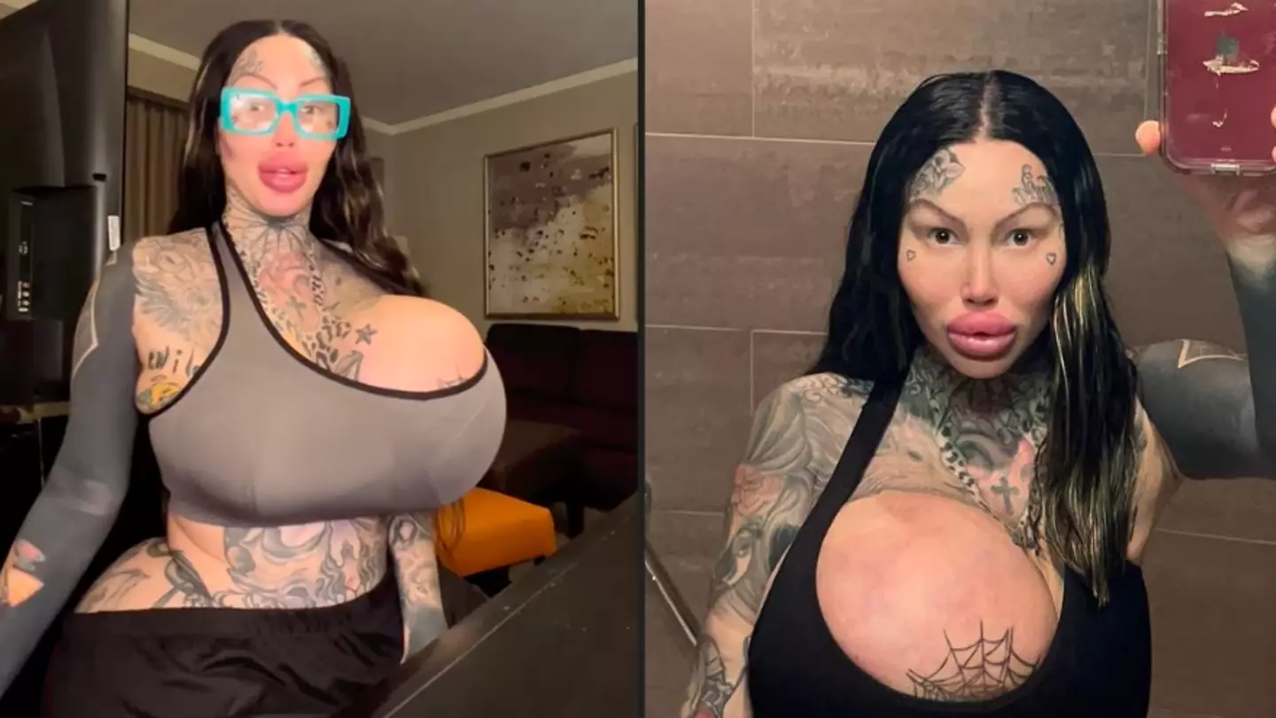 Influencer With Boobs So Big She Had To Buy A New Car Wants To Go Bigger  With Another Enhancement Surgery