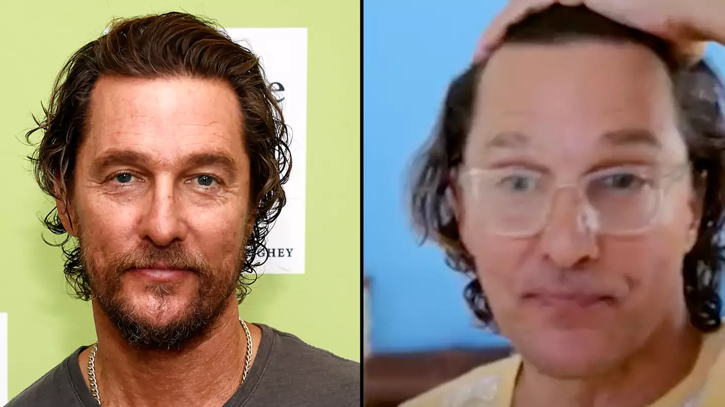 Matthew McConaughey found way to get his hair to grow back after balding in the '90s