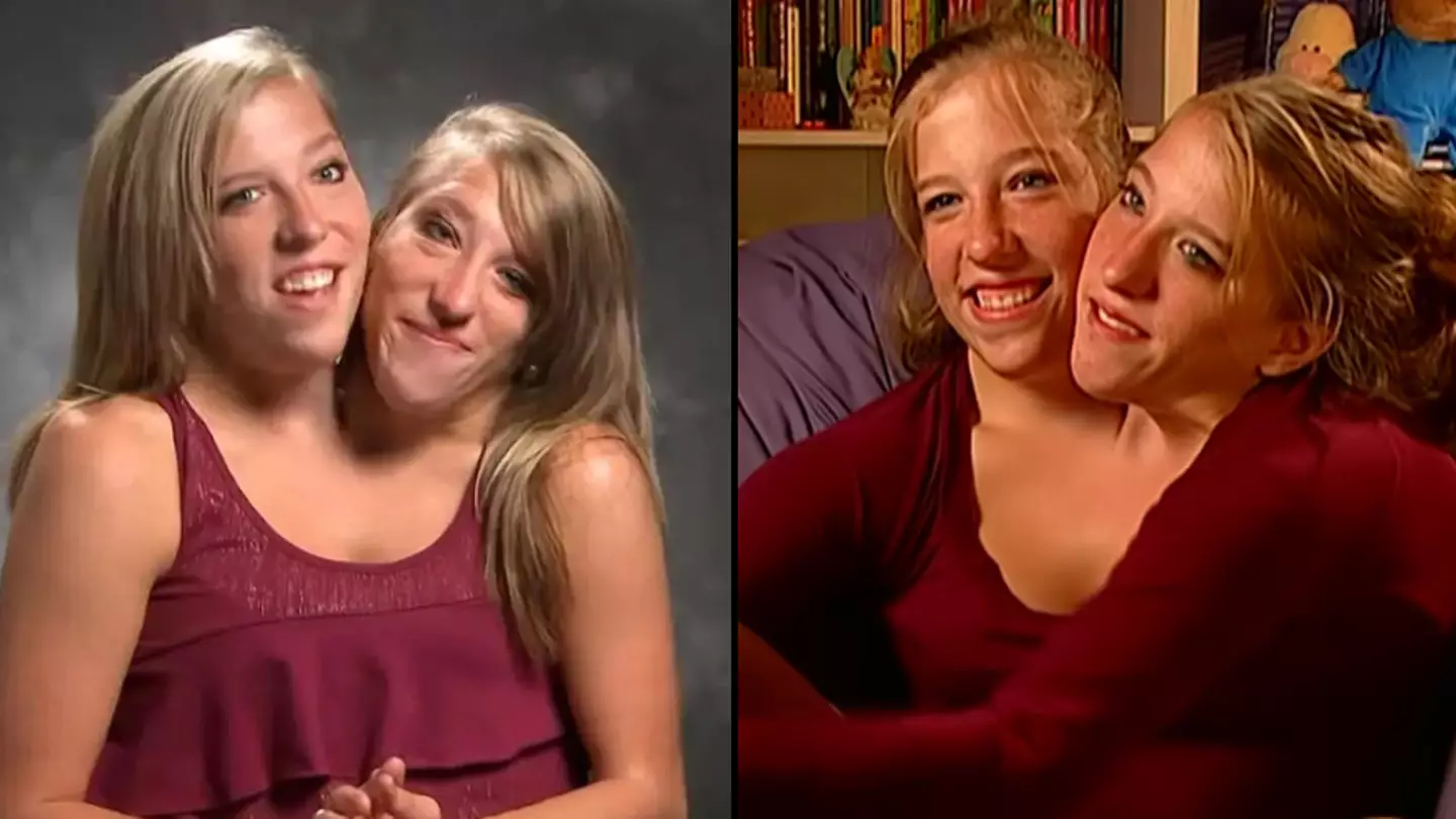 Famous conjoined twins have two separate degrees but only get paid one salary for job