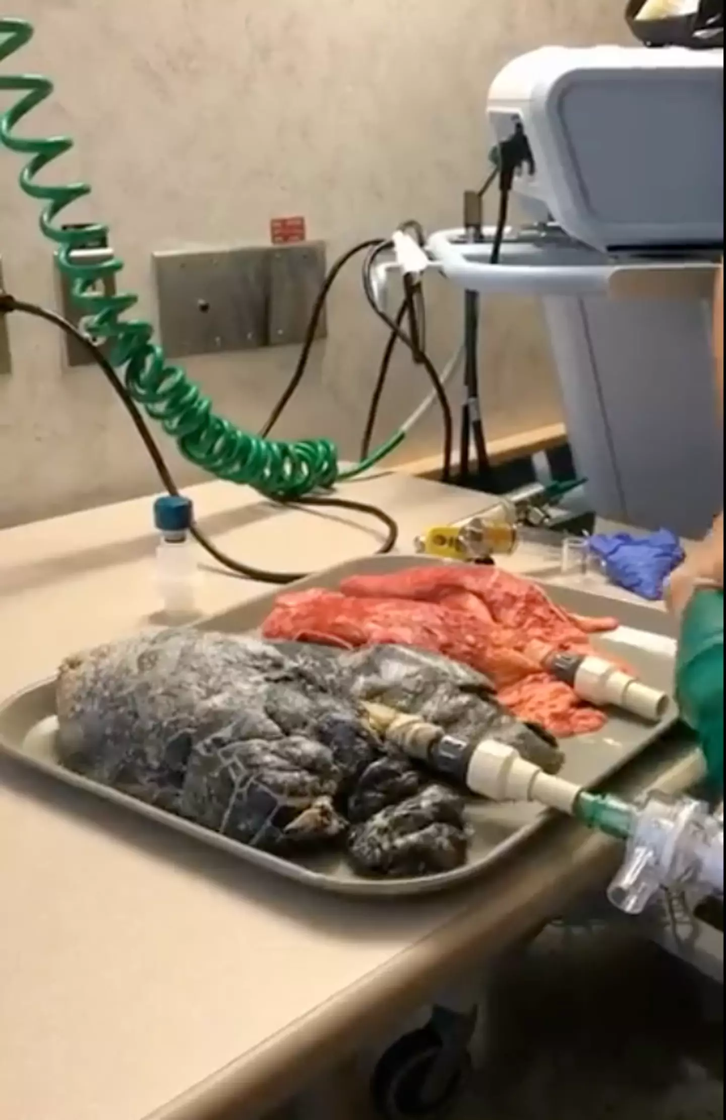The grim video shows what the lungs of a 20-year-long smoker look like.