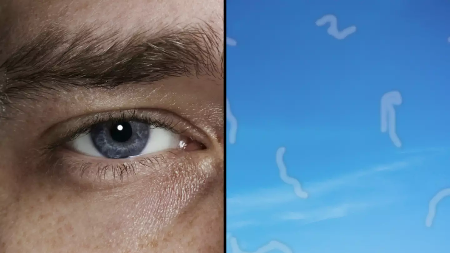 NHS advises when you should seek medical help if you see 'squiggly lines' in your eye