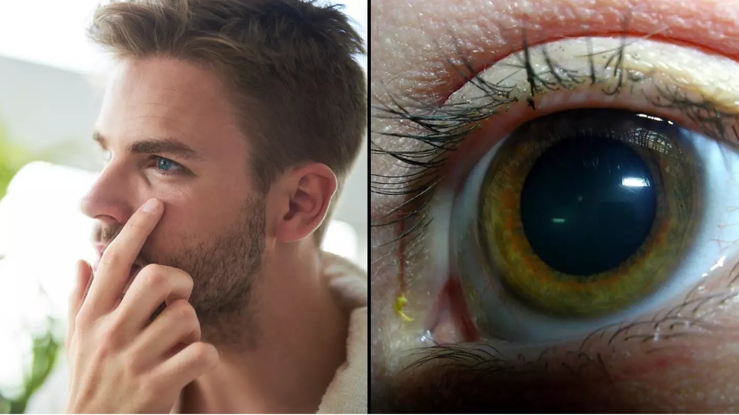 People mind-blown after discovering what yellow ‘sleep’ in eyes when you wake up actually is