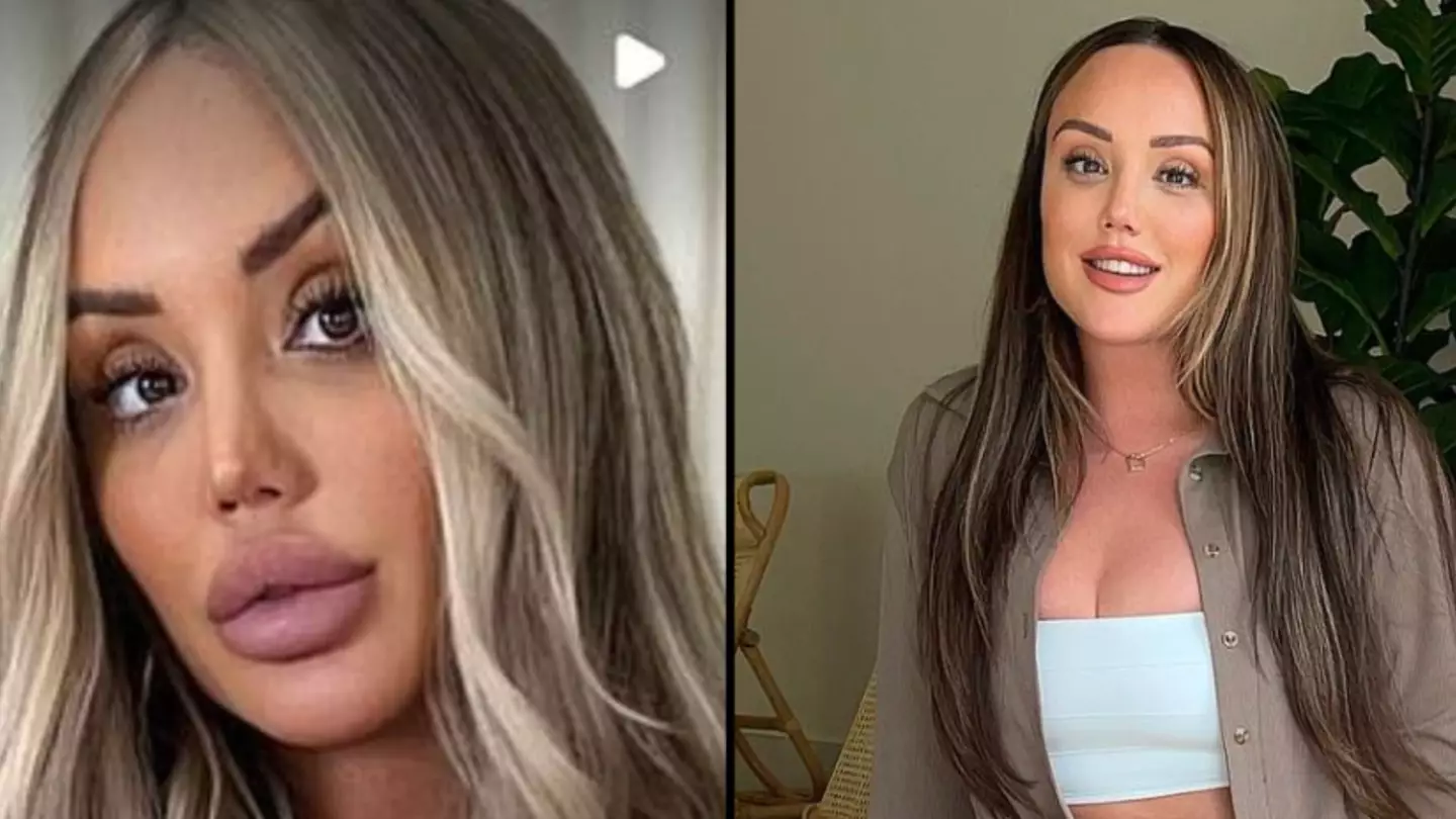 Charlotte Crosby is shocked at how much lip filler she used to have