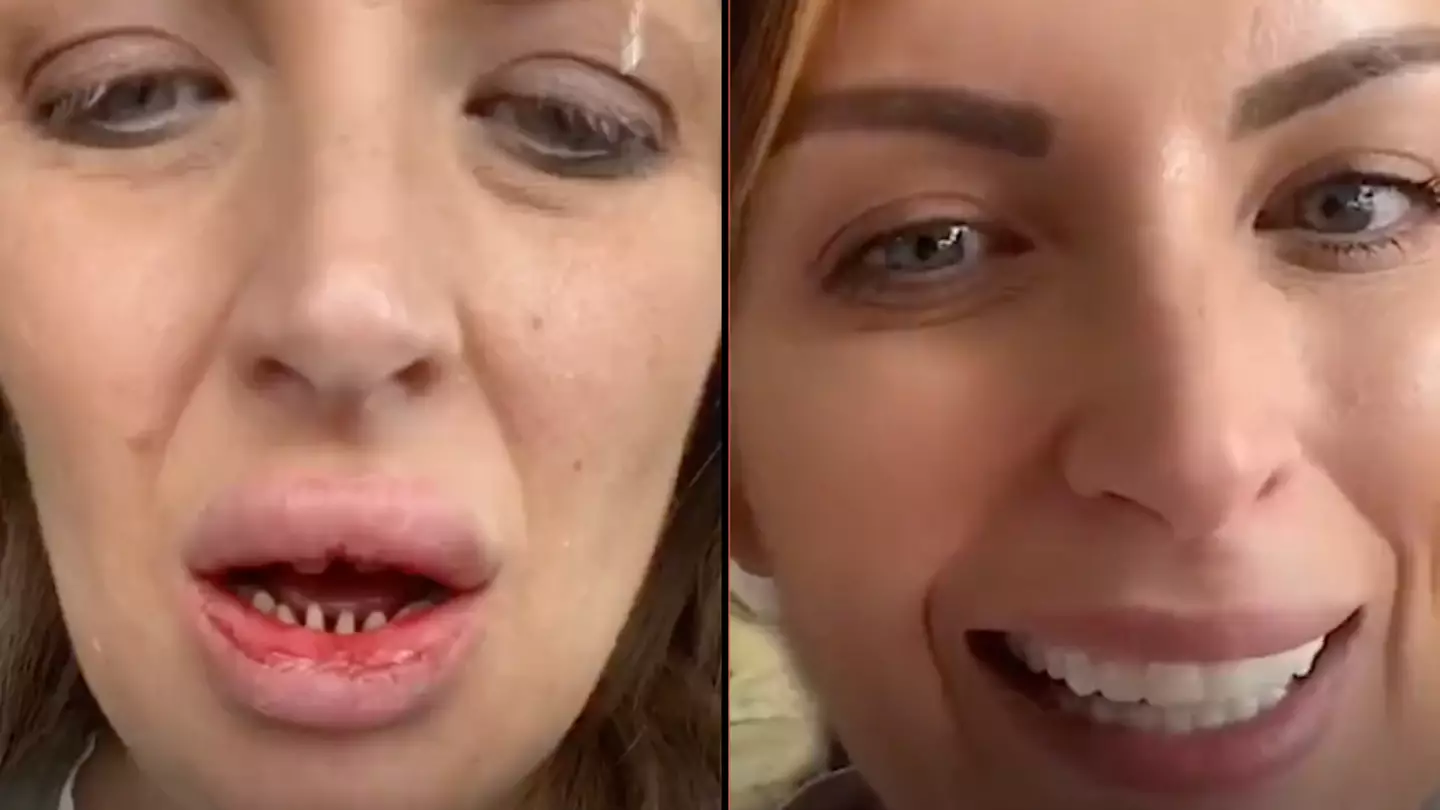 Before And After Photos From Turkish Plastic Surgery Clinic Have Left  People Baffled