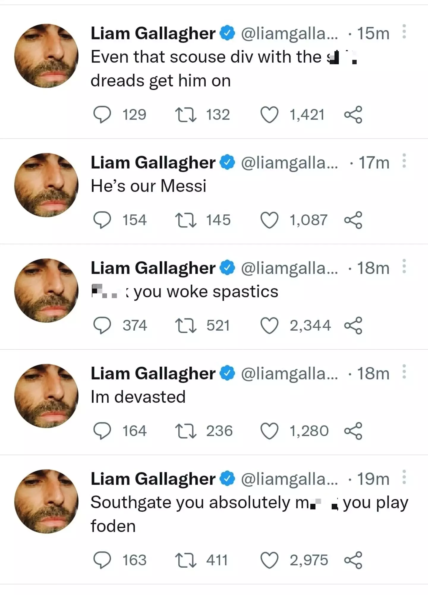 Liam Gallagher tweeted then deleted two ableist slurs.