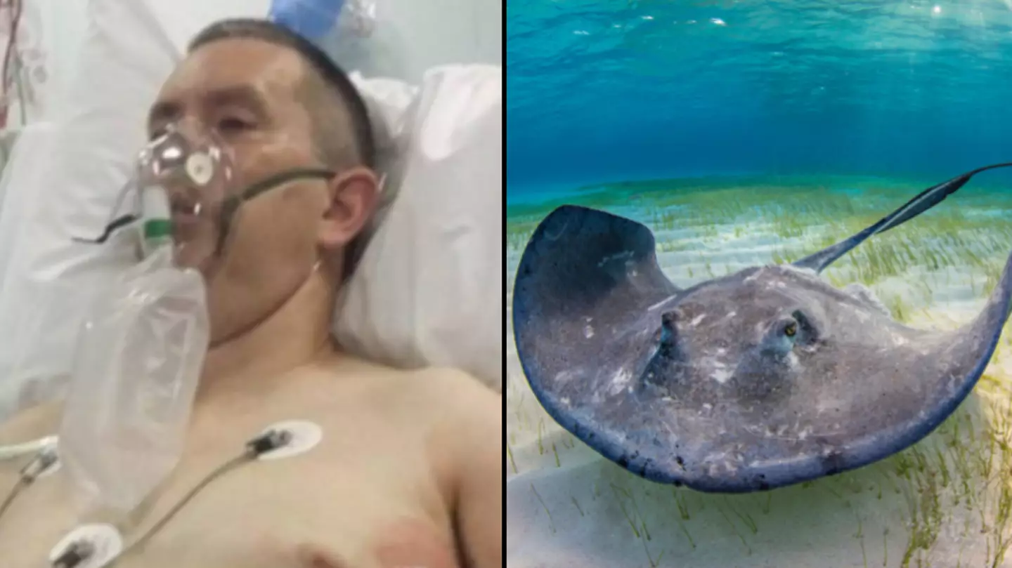 Man Who Almost Died From Stingray Attack Says It's A Good Story