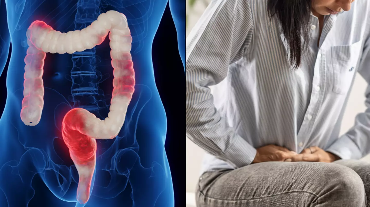 Cause of inflammatory bowel disease has been discovered by UK scientists in major breakthrough