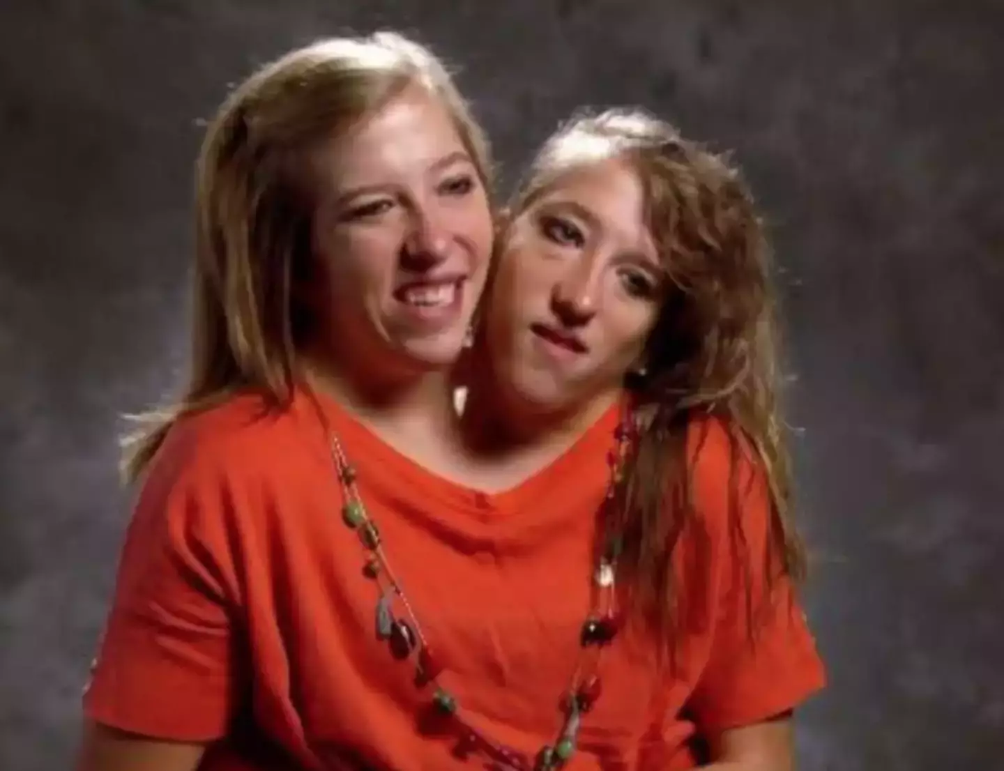 Conjoined twins Abby and Brittany Hensel shared details of Abby's 2021 wedding with Josh Bowling (TLC)