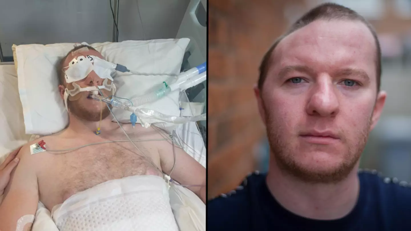 Man left with half a skull after chilling one punch attack