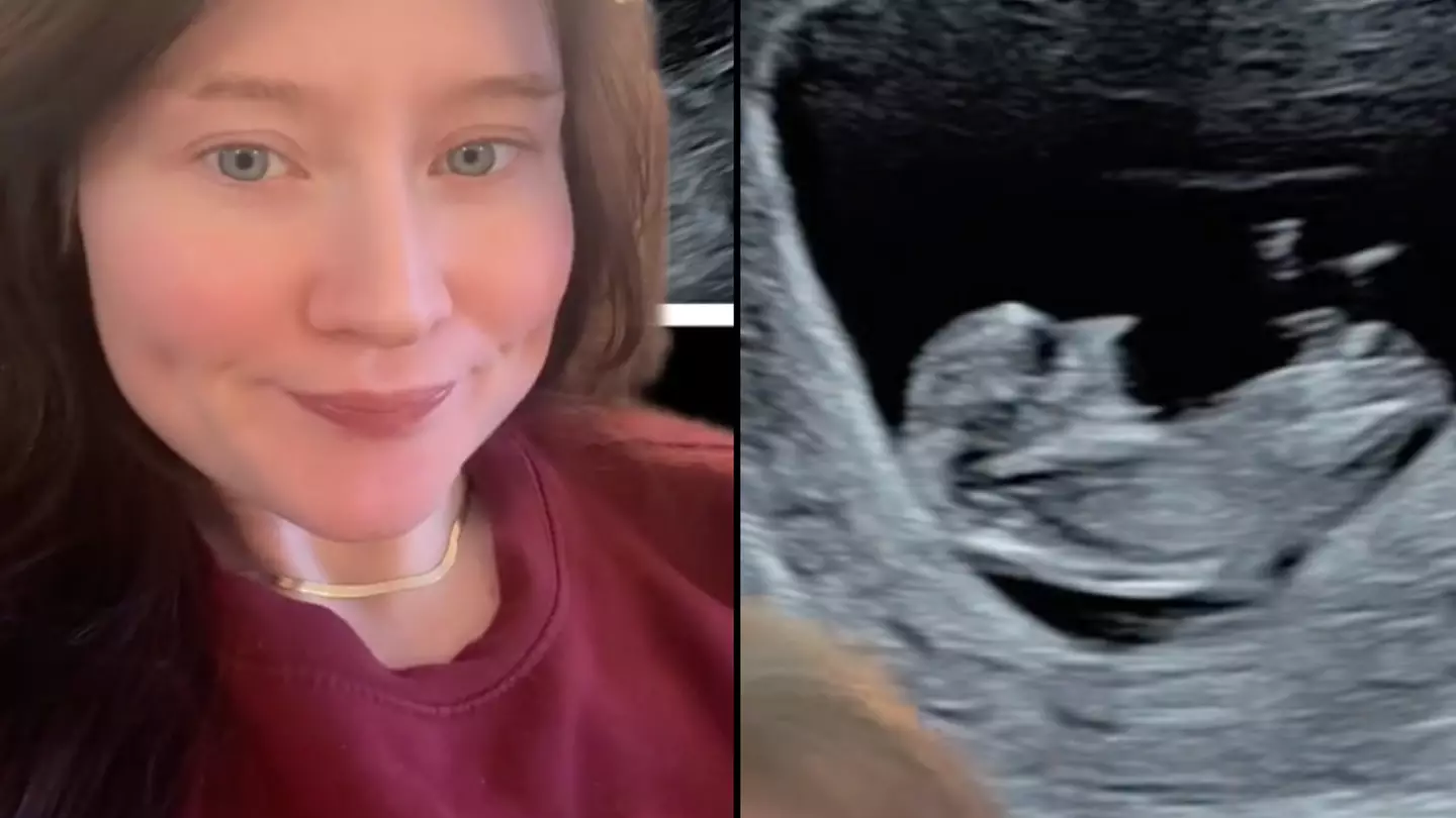 Woman mortified after 'finding Harry Potter character' in her baby scan photo