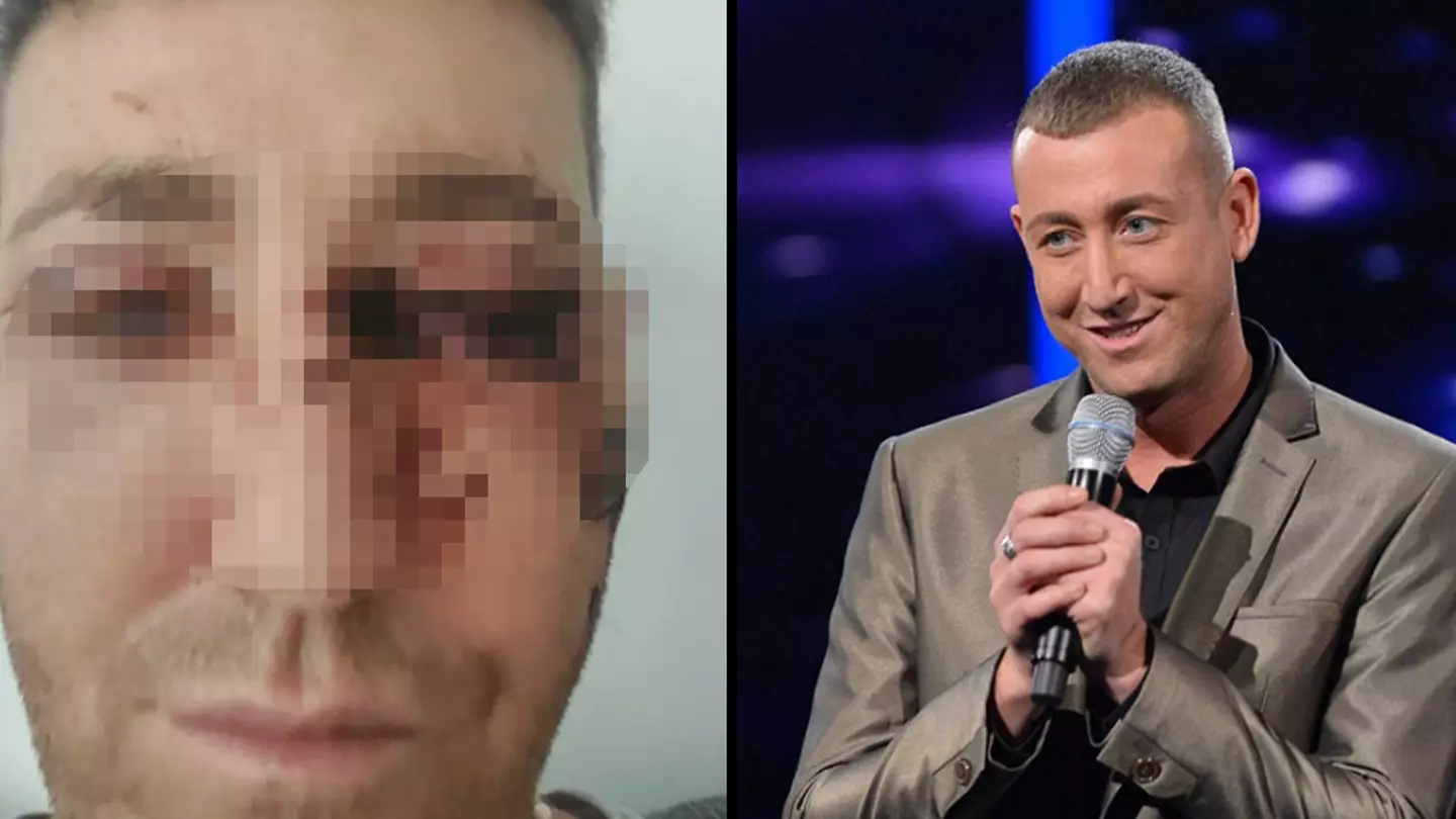 Christopher Maloney begs for help as he admits he's 'gone too far' after his eyelid surgery
