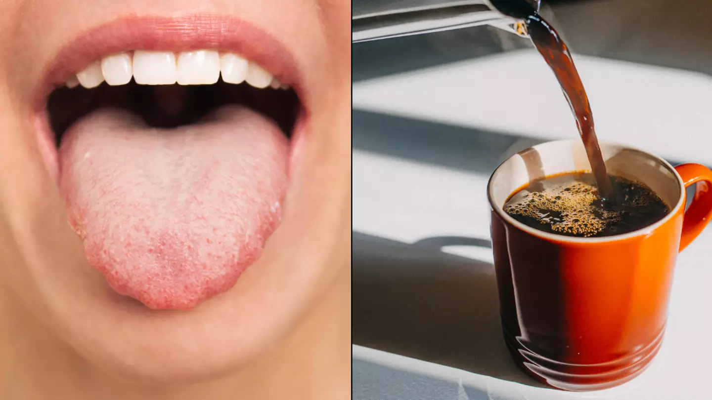 The weird sign on your tongue that shows you 'shouldn't be drinking coffee'
