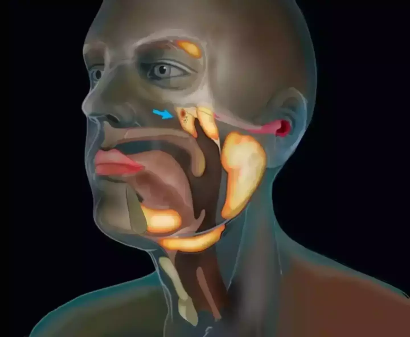 These are where the salivary glands are located.  (Netherlands Cancer Institute)