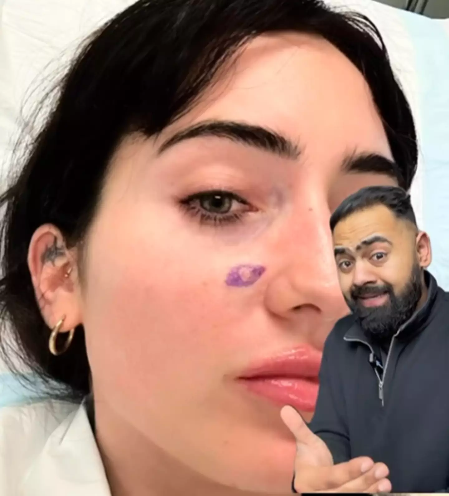 He explained that this pimple was actually BCC.  Instagram/ @drkaranrajan