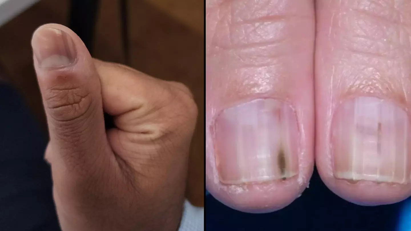 Bloke urged to see doctor after he posts image of his thumb online